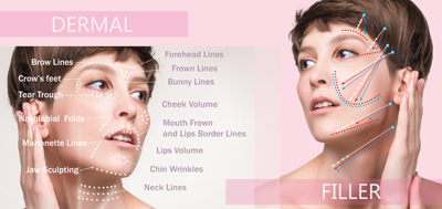Face and fillers Bow